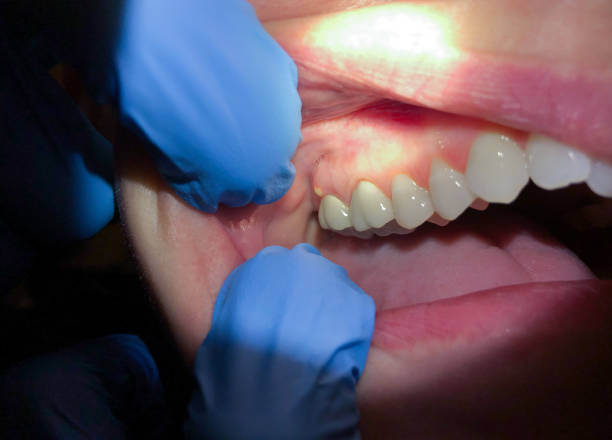 Best Emergency Dentist for Knocked-Out Tooth in Ocean Gate, NJ