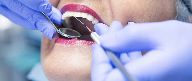 Best Broken or Cracked Tooth Emergency Dentist in Ocean Gate, NJ